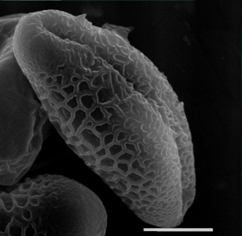 Fig. 1. Pollen grains of Billbergia pyramidalis: А – equator view (SEM, ×2600); Б – group of pollen grains (SEM, ×2400); В, Г – equator view (LM, ×100).