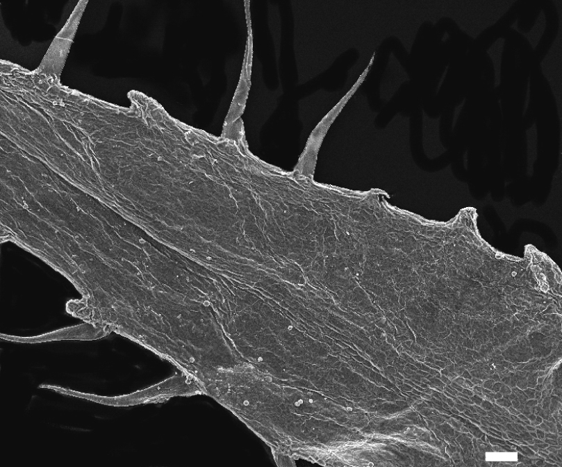 Fig. 1. Spinelets on the edge of calyx lobes in Campanula glomerata subsp. elliptica.