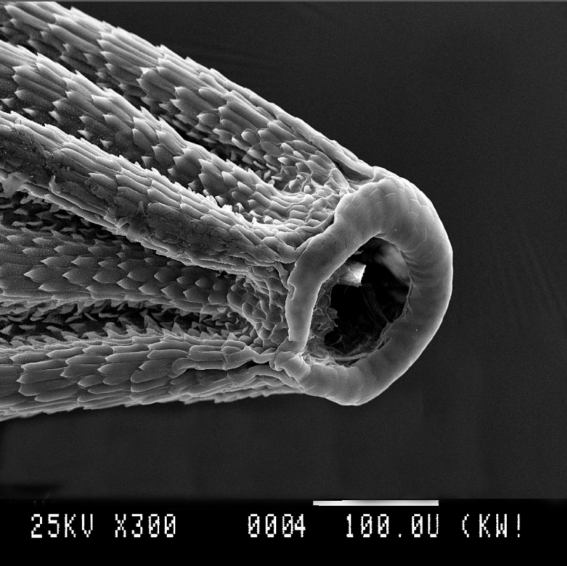 Fig. 1. Sculpture of achenes in sections Prаealtina and Echinina of the genus Pilosella of Crimean flora. Spout of achene (P. procera)