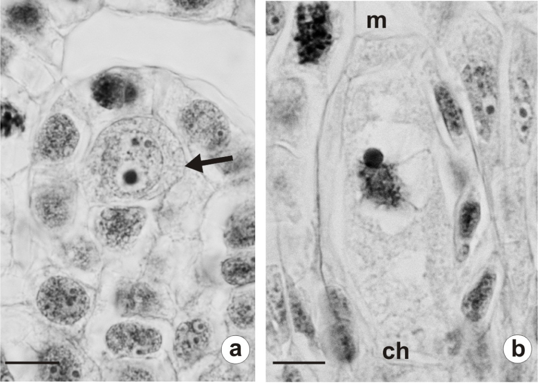 Fig. 1. Longitudinal section of young Rudbeckia laciniata ovules: a – ovule primordium with archesporial cell (arrow); b – early prophase in megaspore mother cell. Abbreviations: ch – chalazal pole; m – micropylar pole. Scale bars: 10 μm.