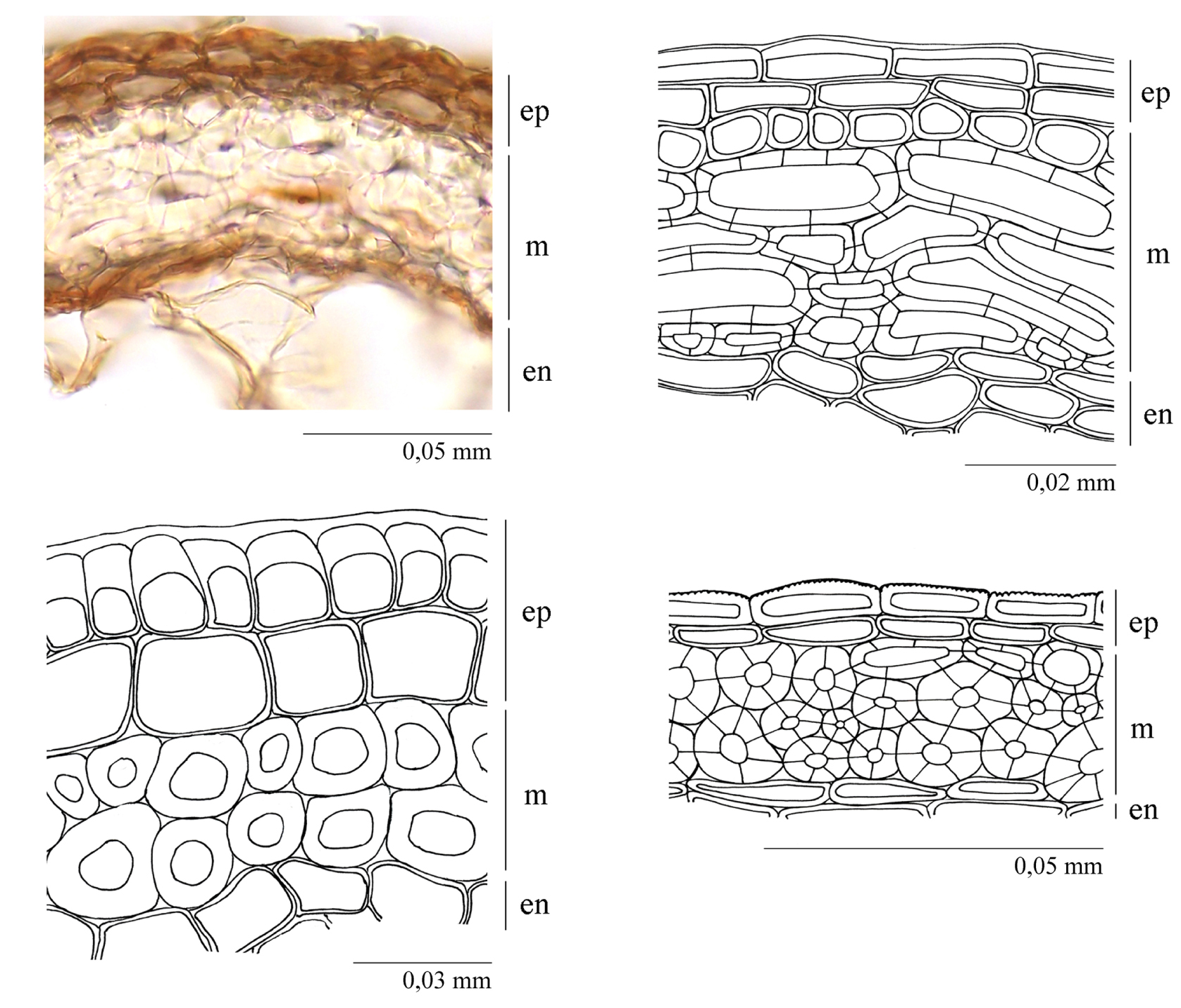 Fig. 4. Pericarp anatomy of the birch fruits: A – Betula lenta; B – B. alleghaniensis; C – B. medwediewii; D – B. grossa. ep – epicarp; m – mesocarp; en – endocarp.