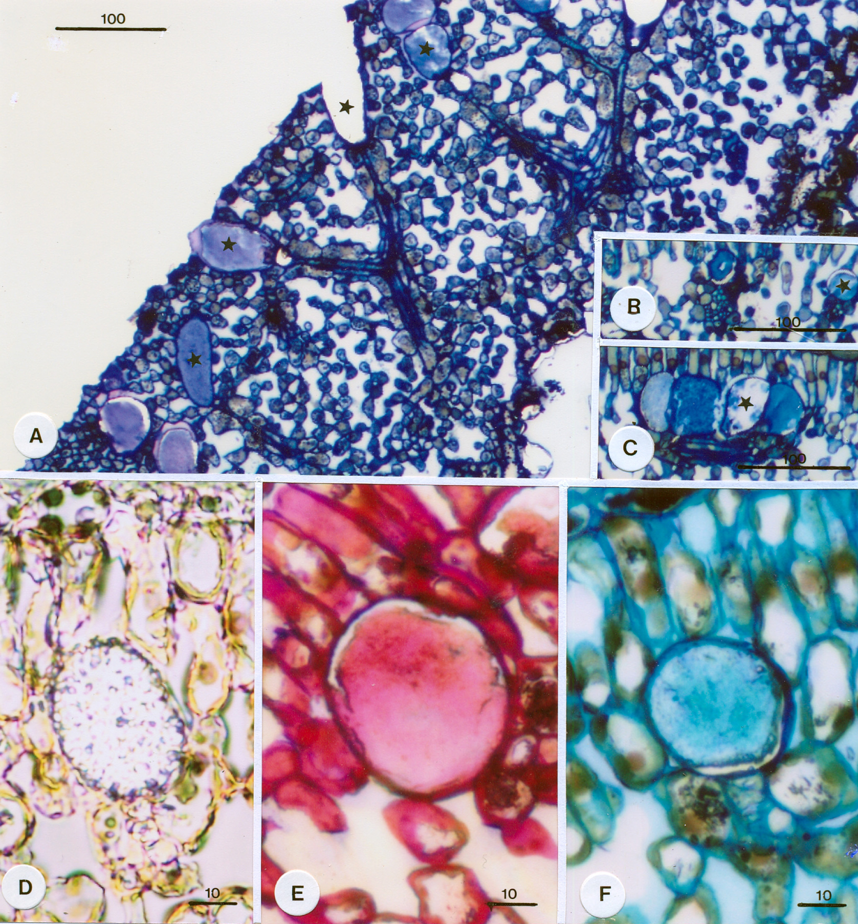 Fig. 2. A – Paradermal section of the leaf at the level of location of the mucilage idioblasts (asterisks). Note the association of the idioblasts with the vascular bundles (longitudinally cut). Isolated (B) and grouped (C) idioblastic mucilage cells in touch with vascular bundles. D-F – Idioblastic cells treated with Sudan Black B for lipids (D), with PAS for polysaccharides (E), and with Coomassie Brilliant Blue for proteins (F). With Sudan Black B, the content of the idioblasts remained unstained (no presence of lipids), with PAS it stained pink (presence of polysaccharides), and with Coomassie Brilliant Blue it stained light blue (presence of proteins). The content, therefore, corresponds to glycoprotein (mucilage). Scale bars in μm.