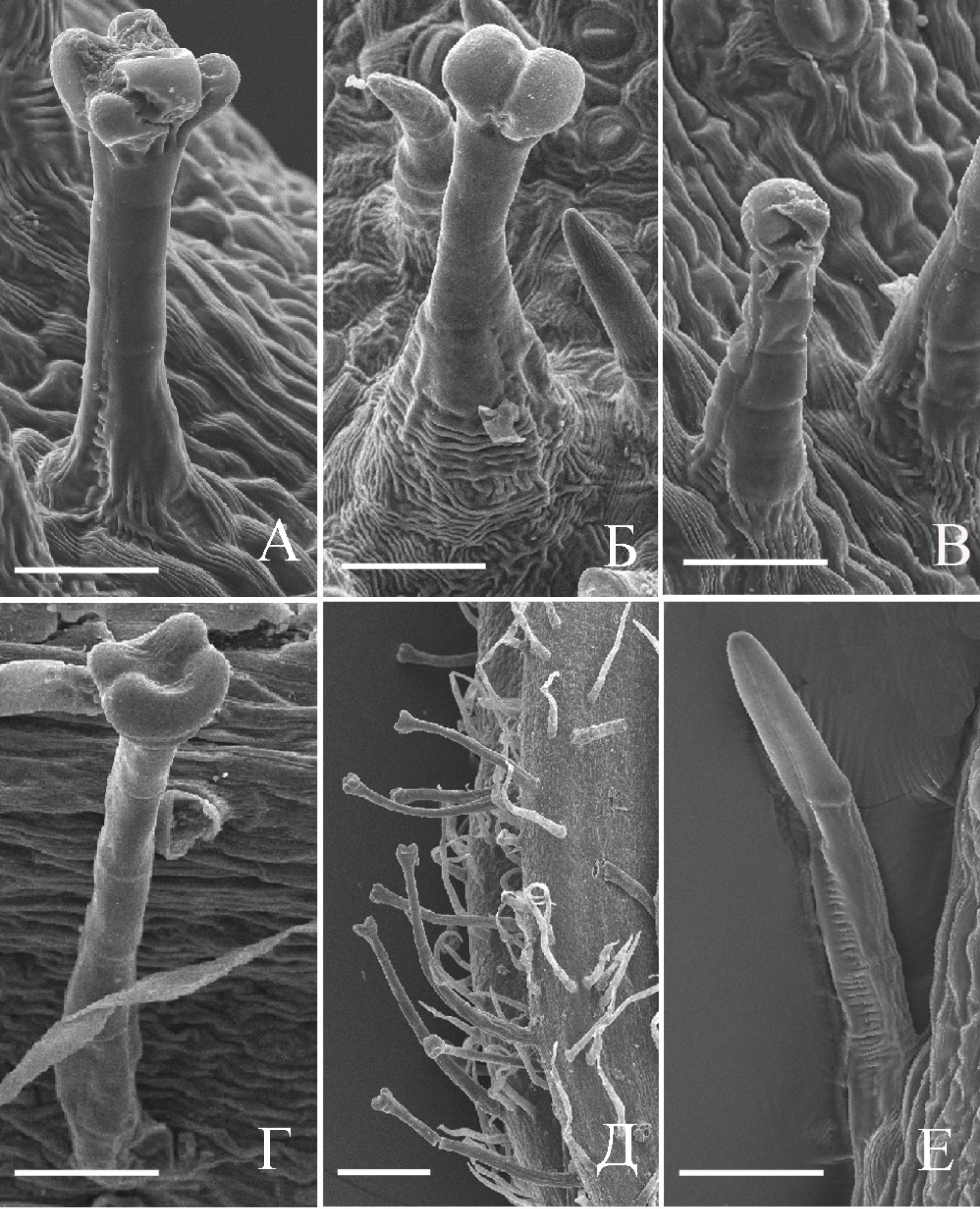 Fig. 1. Morphological types of the glandular and non-glandular trichomes in Doronicum orientale (А-В, Е) and D. macrophyllum (Г, Д): А – 1st-type trichome; Б – 2nd-type trichome; В – 3rd-type trichome; Г – 2-celled trichome; Д – common view of the phyllary edge; Е – a simple non-glandular trichome. Scale bars: А-Г, Е – 50 µm; Д – 200 µm.