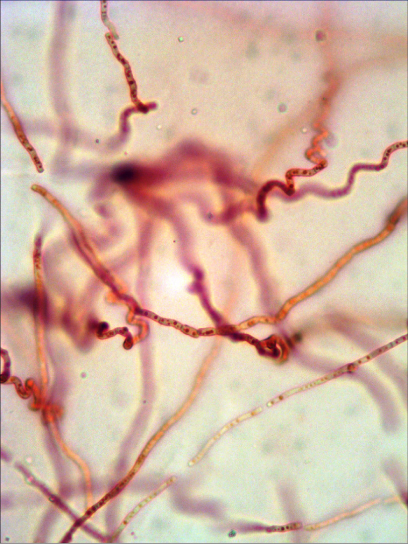 Fig. 1. Contorted and widened hyphae of Cladosporium sphaerospermum 312 FCKU mycelium in ChDA medium with 0.1% of saccharose content.