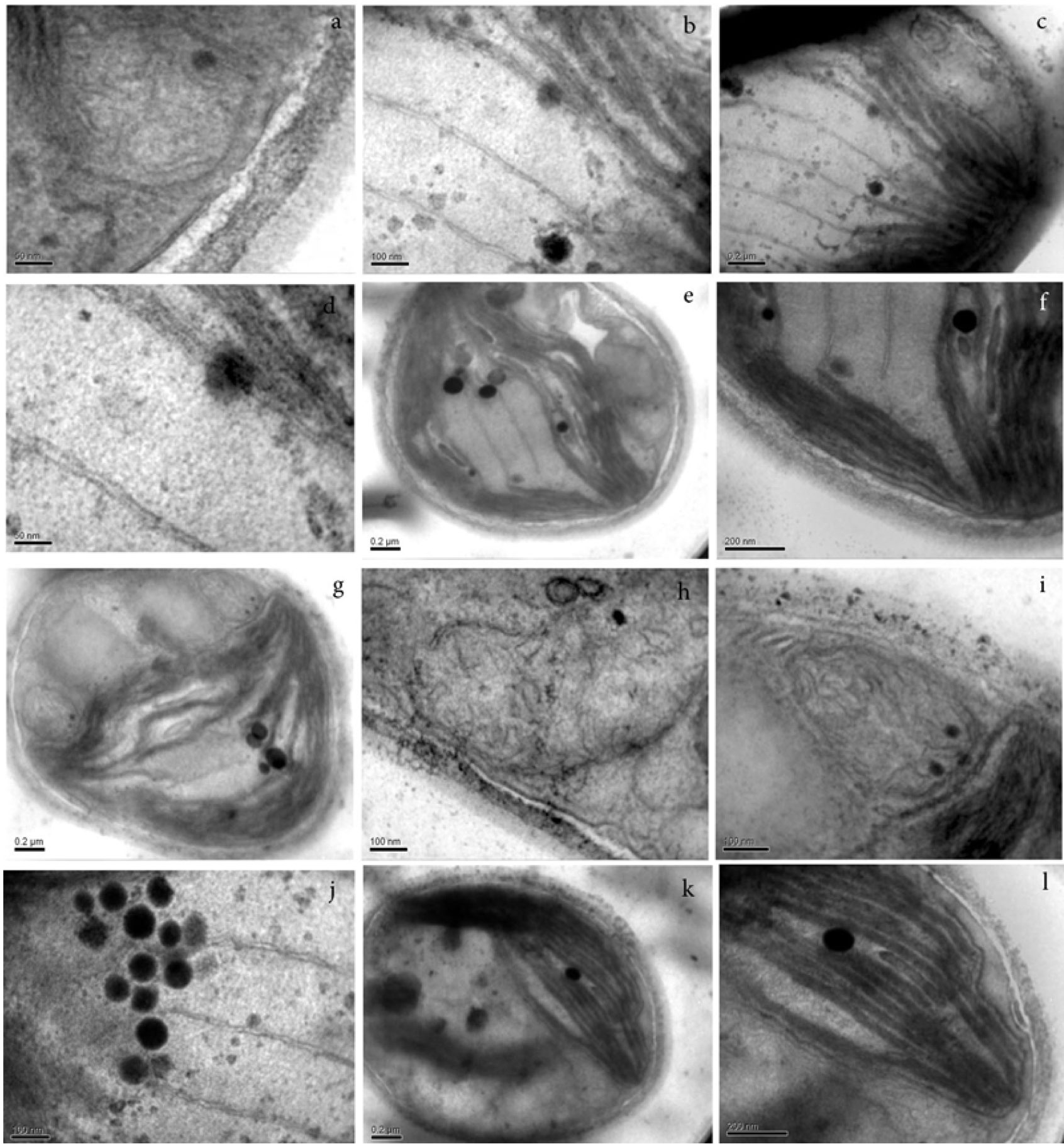 Fig. 1. Ultrastructure features of cell of the Stichococcus-like algae (on example of ACKU 868 Stichoccocus bacillaris): a – double-layer membrane; b – lamella consisting of 2-4 thylakoids; c – lens-like elongated naked pyrenoid; d – pair of lamellas that permeate the pirenoid; e, j – pyrenoglobule; f – plastoglobule; g – mitochondrial profile; h, i – mitochondrial profile pressed to the chloroplast; k, l – parietal chloroplast.