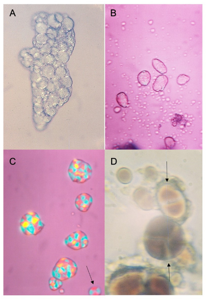 Composite starch granules: A – Avena pilosa; B – A. eriantha; C, D – A. wiestii. A-D are taken under a light microscope; A-C under a polarised light; D – shows the granules stained in a Lugol’s solution. Microscopic magnification: A-C – ×320; D – ×800.
