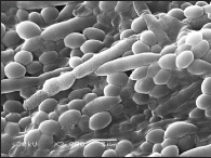 Fig. 2. Black yeast-like fungi of Exophiala sp.: А – hyphal structures of fungus at MEA.