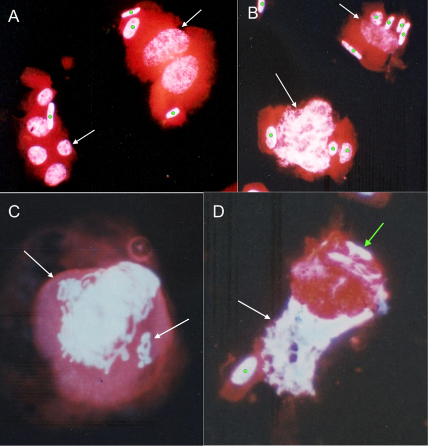 Nuclear antipodal morphology at the free-nuclear endosperm stage in Avena sativa: A – two multinuclear (2 and 5 nuclei) antipodals (arrows) showing the different levels of ploidy and phase of the cell cycle; B – two uninuclear antipodals (arrows) with various DNA amplification and, probably, at a different stage of prophase; C – a highly polyploidised antipodal cell at prophase stage with two groups of laggard chromosomes (arrows); D – a partly apoptotised antipodal nucleus (white arrow) and semi-telophase of a small nucleus (remnant DNA) perhaps was formed from the laggard chromosomes (see green arrow). Other nuclei, not from antipodals, are marked by green dots. A-D – DAPI and propidium iodide sequential staining.