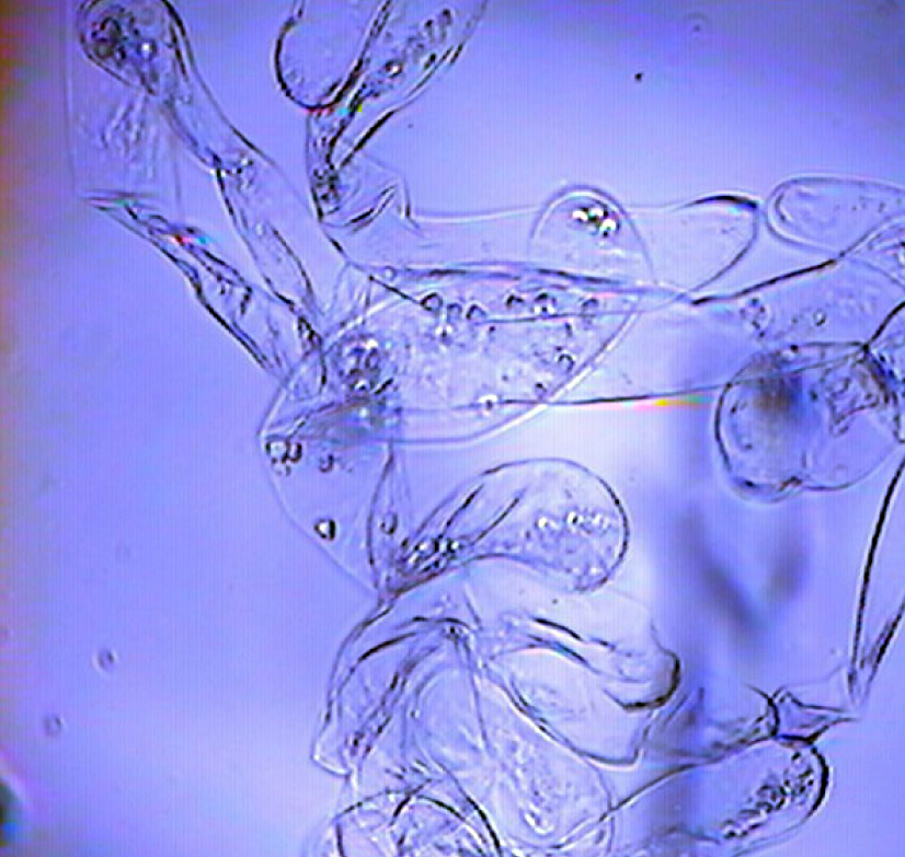 Fig. 1. Reserving callus cells of Astragalus dasyanthus.