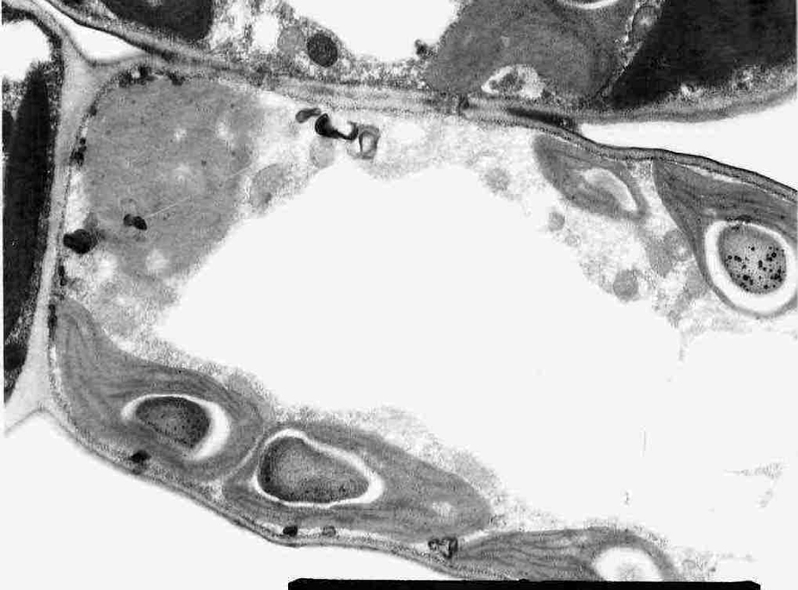 Fig. 1. The fragments of mesophyll cells of floating leaves of Trapa natansю