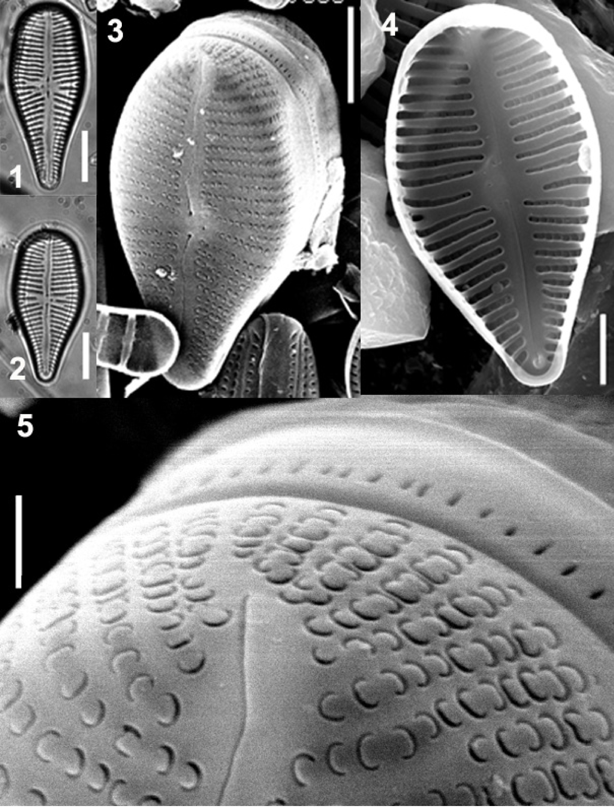 Fig. 1-5. Gomphonema italicum Kütz.: 1-2 – view from the valve; 3 – outer valve surface; 4 – inner valve surface; 5 – fragment of the outer valve surface from the head pole, C-like areolae in the striae that go on the mantle without interruption, distal fissure on the mantle. Fig. 1-2 – light microscopy, Fig. 3-5 – SEM. Scale bars: 1-2 = 10 µm, 3 = 5 µm, 4 = 2 µm, 5 = 1 µm.