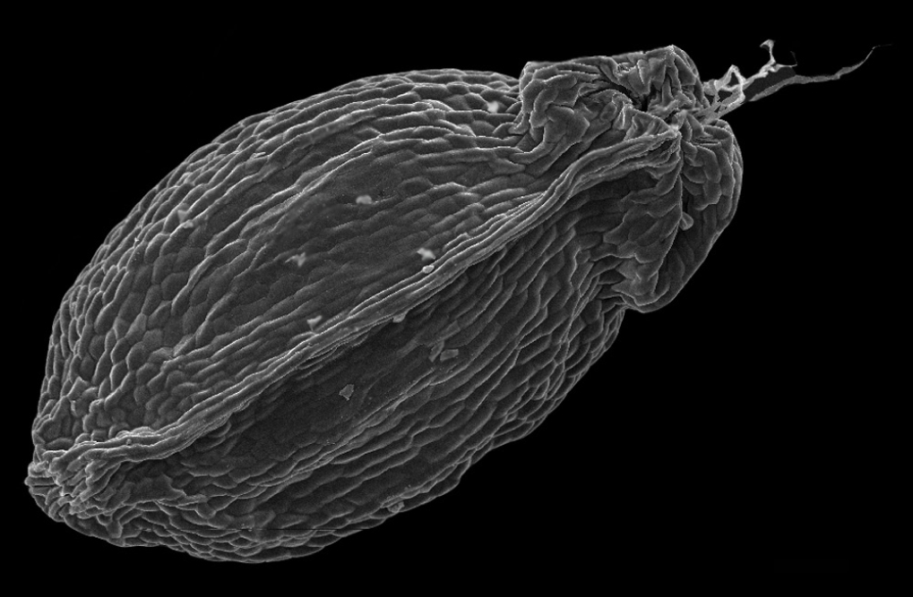 Fig. 1. Seed of Luzula taurica (V.I. Krecz.) Novikov (upper four seed photographed an increase in ×78, the surface ultrastructure of seeds – an increase ×660).