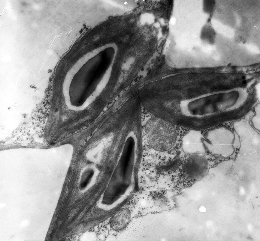Fig. 1. Chloroplast structure of mesophyll cells of spring wheat variety «Nedra» under nature drought conditions (scale: 1 cm = 500 μm).