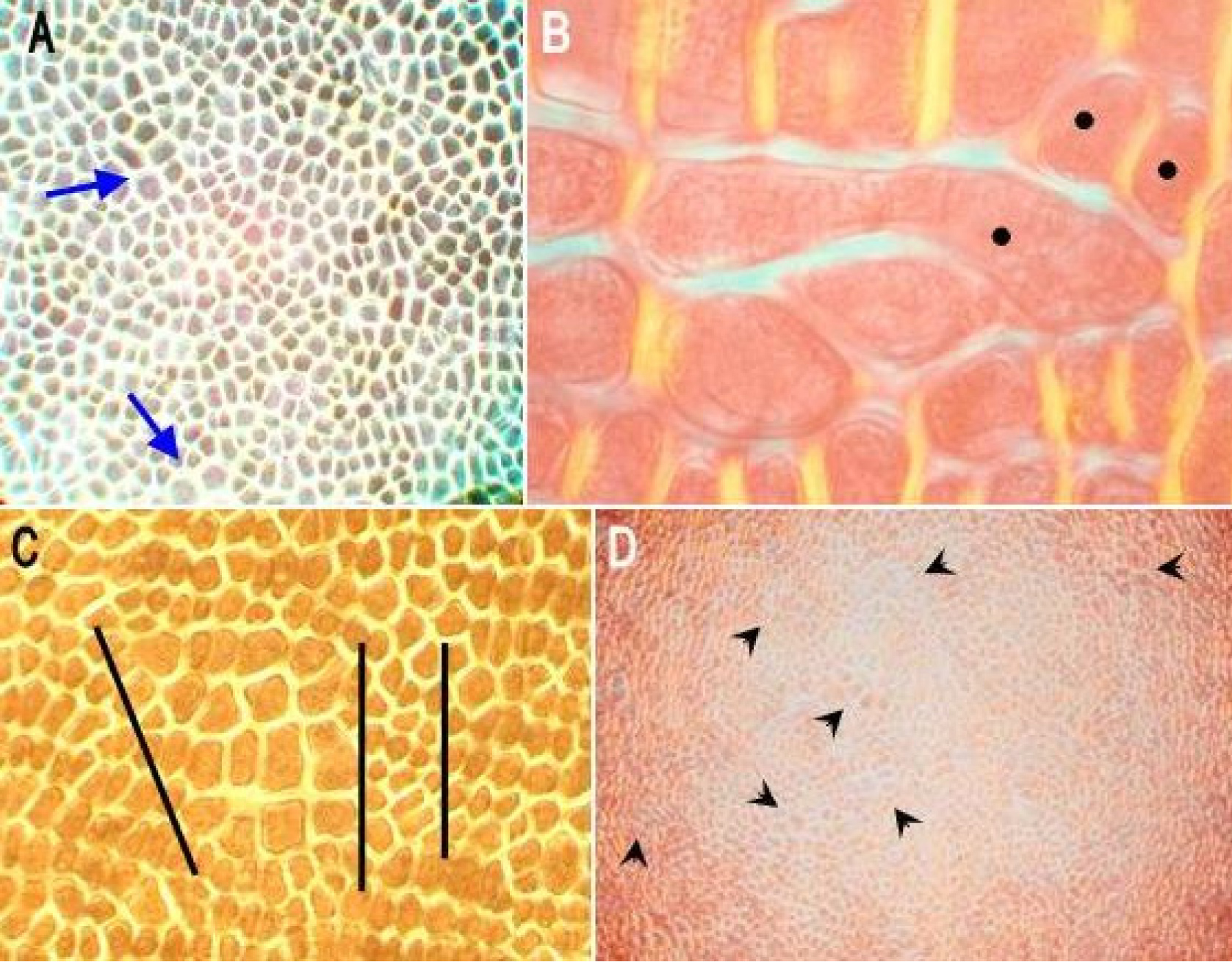 Fig. 1. Developmental mosaics of aleurone layer (surface views) in irradiated caryopses of barley: A – an aleurone layer expressing lighter and darker patches of cells with less or more protein, respectively (stained by bromophenol blue). Two clones of larger cells are marked by arrows; B – three cells (black dots) expressing changed cell cycles – a large cell is developed as omitting at least two cytokineses; two small cells are created after one additional cytokinesis, in excess when compared to normal aleurone cells; C – a mosaic of aleurone layer with two adjacent clones of large and small cells, marked by black lines; D – a large fragment of aleurone layer with increased frequency of mutated cell clones, some are marked by arrows. Pictures B, C and D are taken under a polarising microscope.