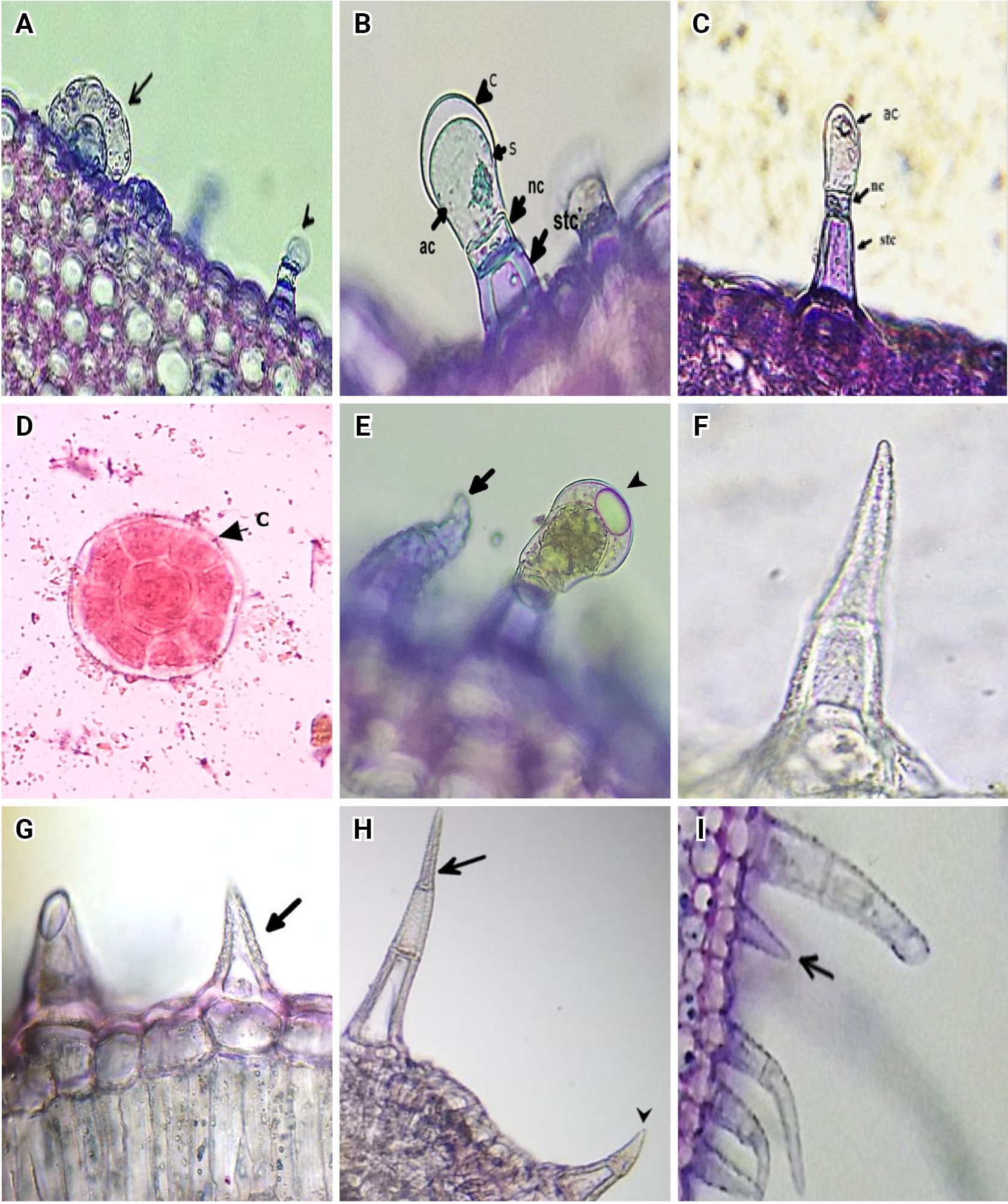 Figure 1. Trichomes of Acinos alpinus subsp. meridionalis