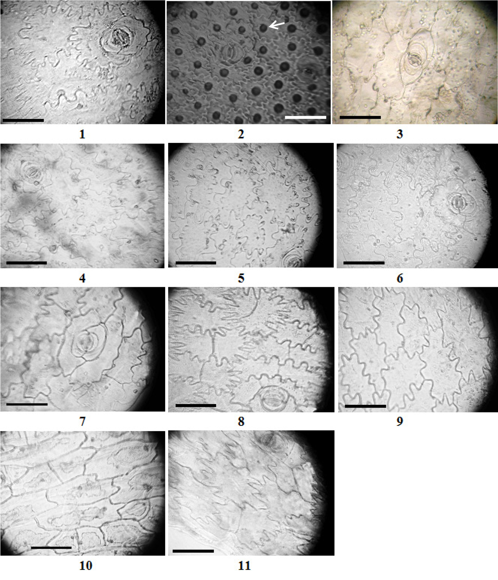 Fig. 1 Epidermal cells of Rebutia flavistyla (1), Astrophytum myriostigma (2), Rebutia senilis (3), Echinopsis mirabilis (4), Mamillarіa columbiana (5), Mammillaria prolifera (6), Melocactus maxonii (7), Melocactus sp. (8), Oreocereus celsianus (9), Echinopsis eyriesii (10), Trichocereus peruvianus (11). Scale bars – 100 µm. Arrow marks papillas.