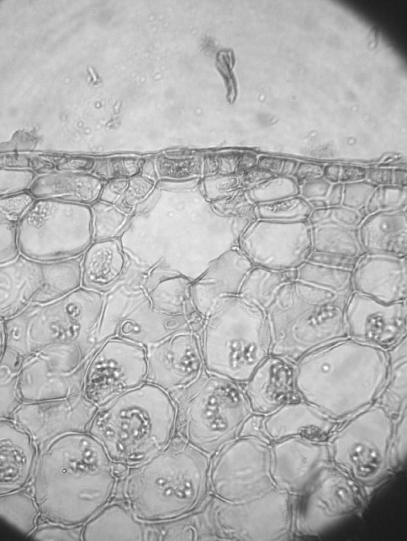 Fig. 1. Chlorenchima in shoots of Euphorbia epiphylloides.