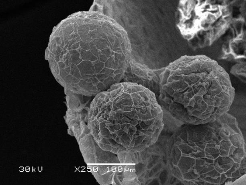 Fig. 7. Microsporangia of Salvinia natans.