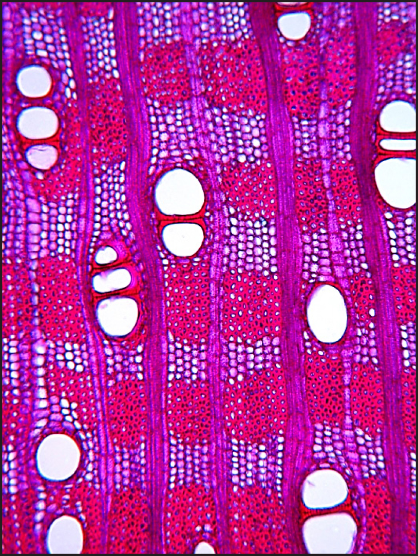 Fig. 1. Transverse section, stem wood. Scale: 90 µm.