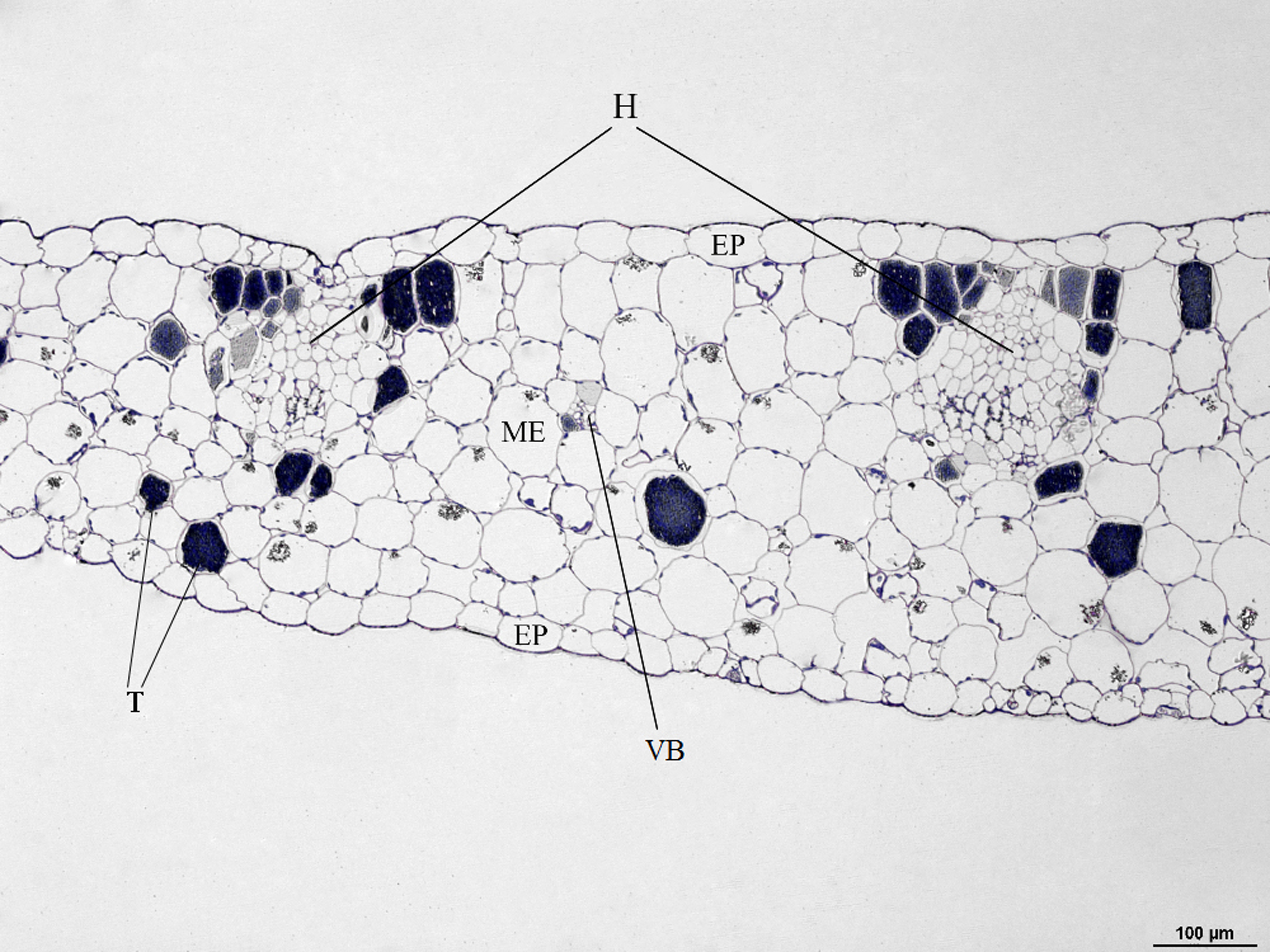 Fig. 2. Light micrograph of a cross section of the leaf Crassula cordata: H – hydathodes; EP – epidermis; ME – mesophyll; T – tannin cells.